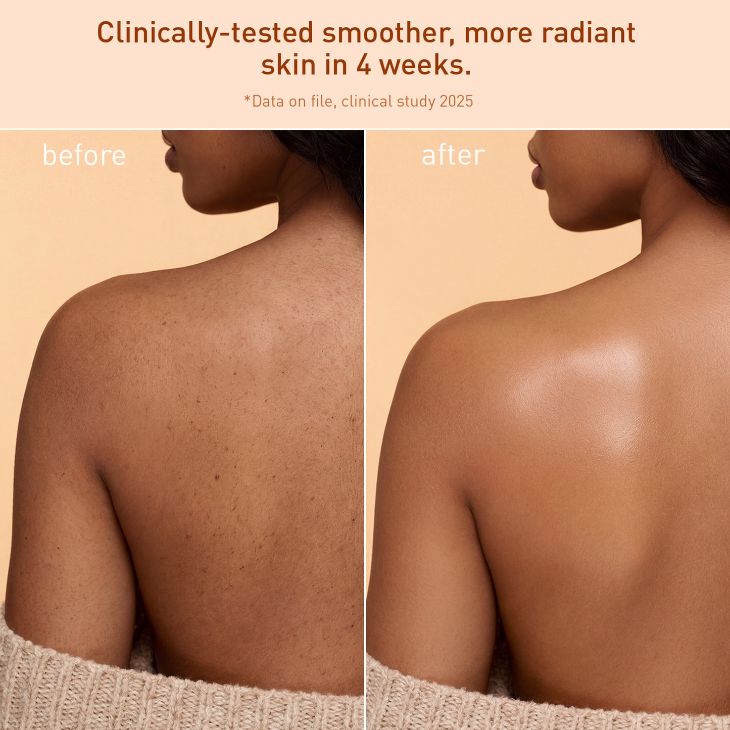 Voshbon Moisture Freeze-Dried Body Wash Voshbon Beauty